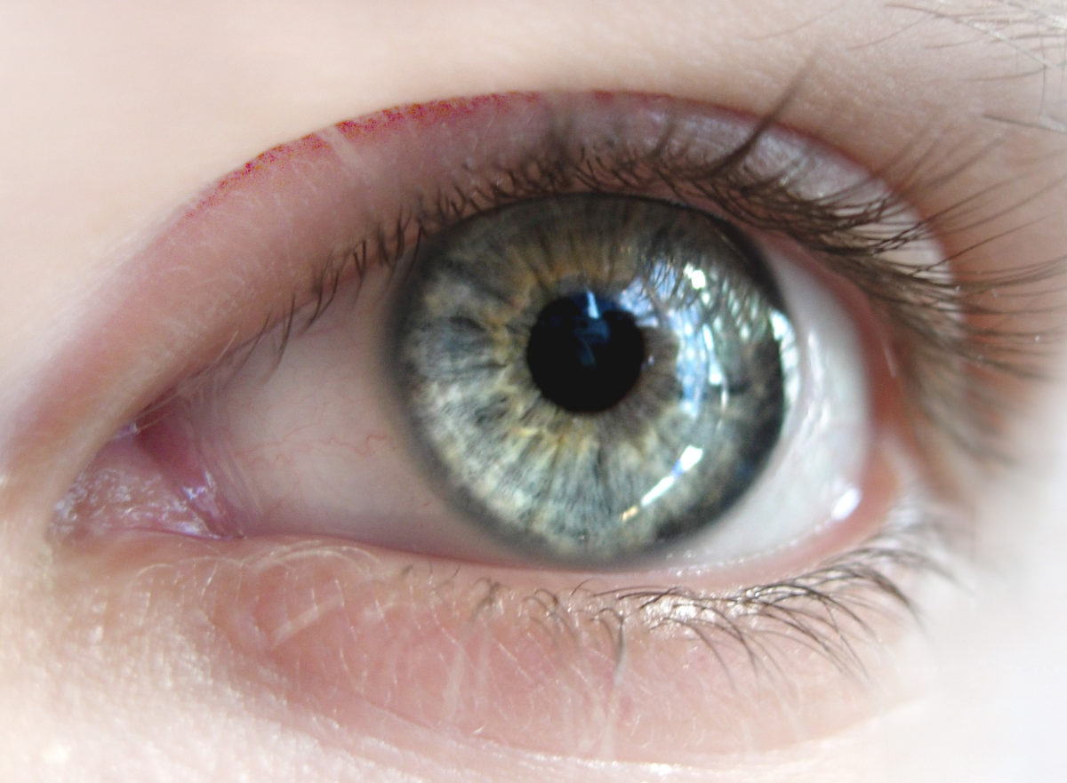 Observation
